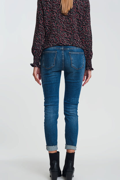 Calça jeans skinny de cintura alta em azul escuro com detalhes rasgados